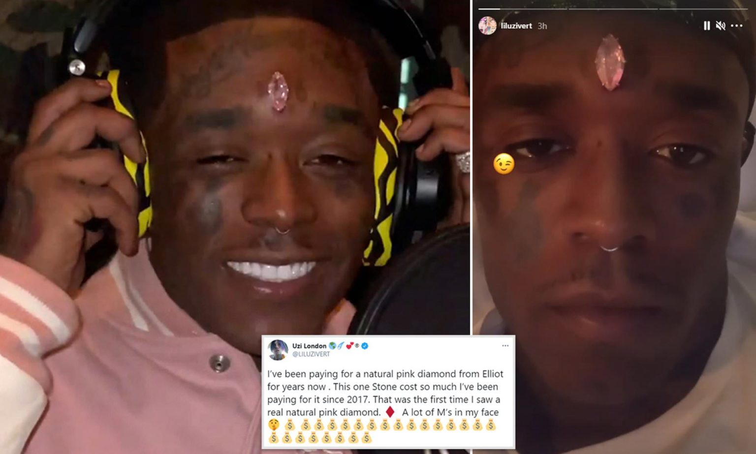 Rapper Lil Uzi Vert Gets 24 Million Pink Diamond Implanted Into His